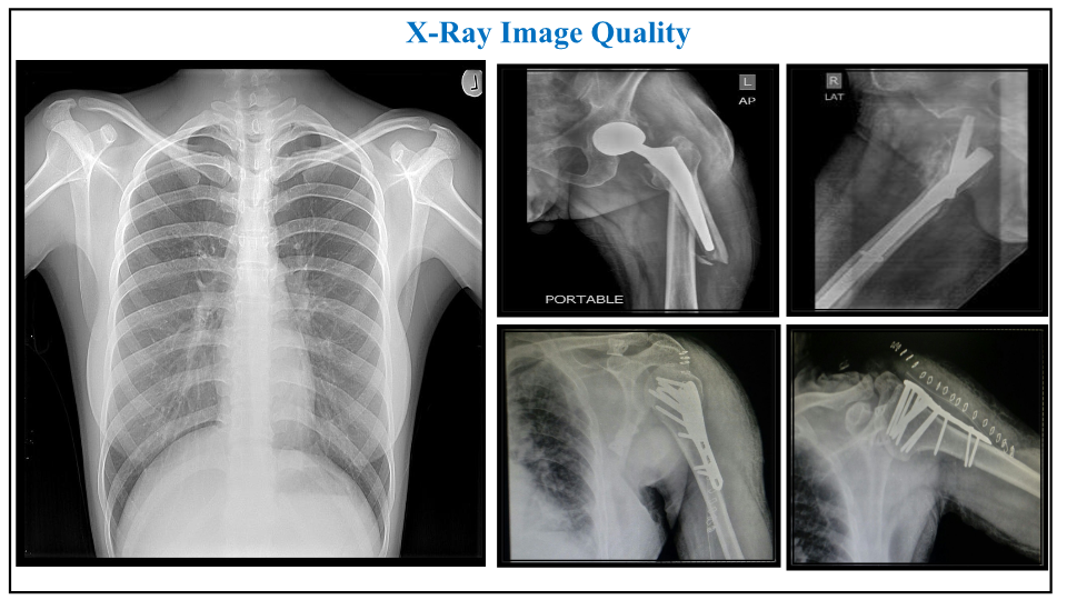 RCSatellite X-Ray